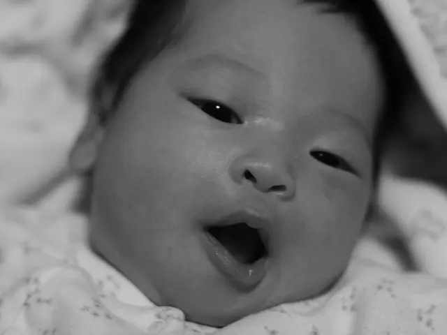 Mouth Thrush: Causes, Remedies, and Preventive Measures